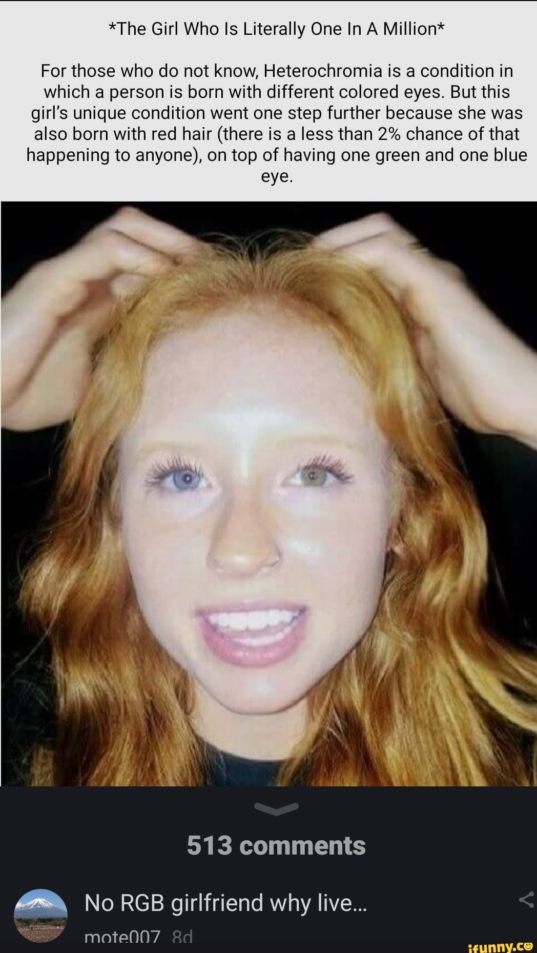 The Girl Who Is Literally One In A Million For Those Who Do Not Know