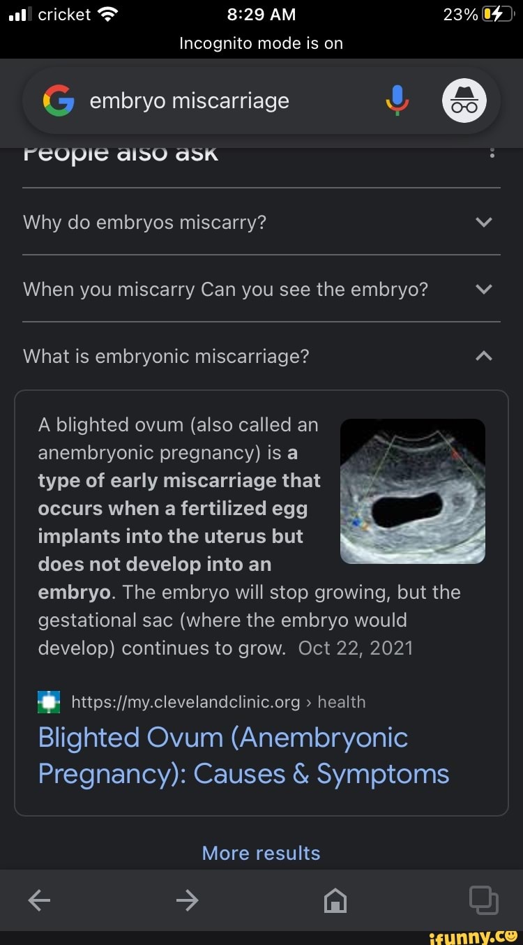 anembryonic-pregnancy-what-it-is-how-to-identify-it-and-what-to-do