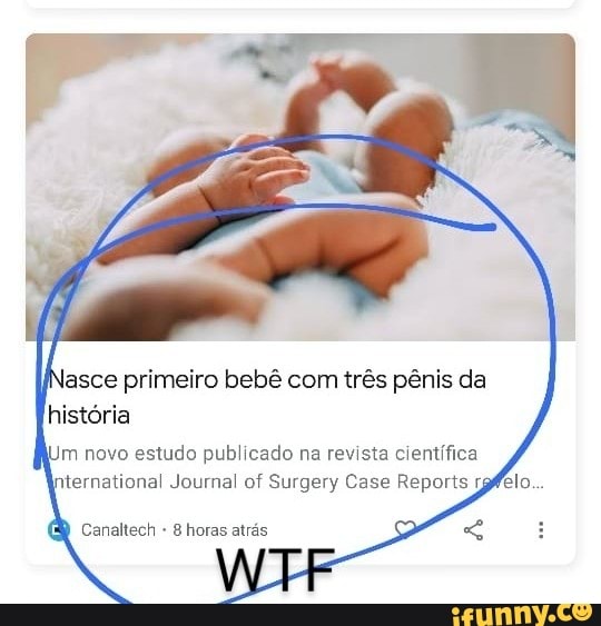 sce primeiro bebê com três pênis da história
im novo estudo publicado na revista científica iternational Journal of Surgery Case Reports
Canaltech - 8 horas atrás