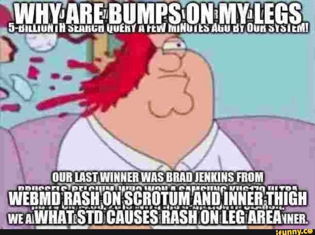 rere
pre Rea
Celeron ERIN
WEBMD RASH,
O INNER THIGH
WEAIWHAT:STO. 'CAUSES: RASH ON LEG (AREA eR: