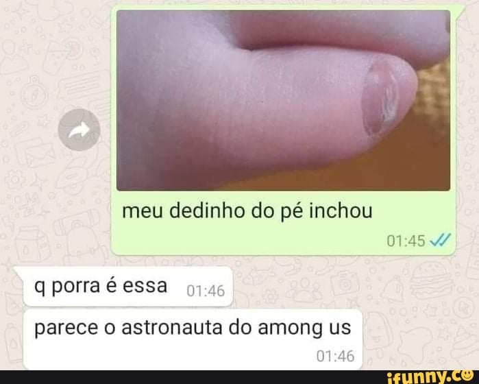 meu dedinho do pé inchou
I porra é essa
parece astronauta do among us