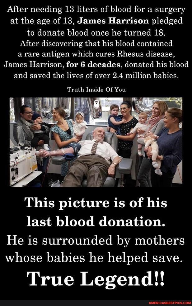 After needing 13 liters of blood for a surgery at the age of 13, James Harrison pledged to donate blood once he turned 18.
After discovering that his blood contained a rare antigen which cures Rhesus disease,
James Harrison, for 6 decades, donated his blood and saved the lives of over 2.4 million babies.
Truth Inside Of You
adS M:
This picture is of his last blood donation.
He is surrounded by mothers whose babies he helped save.
True Legend!!
