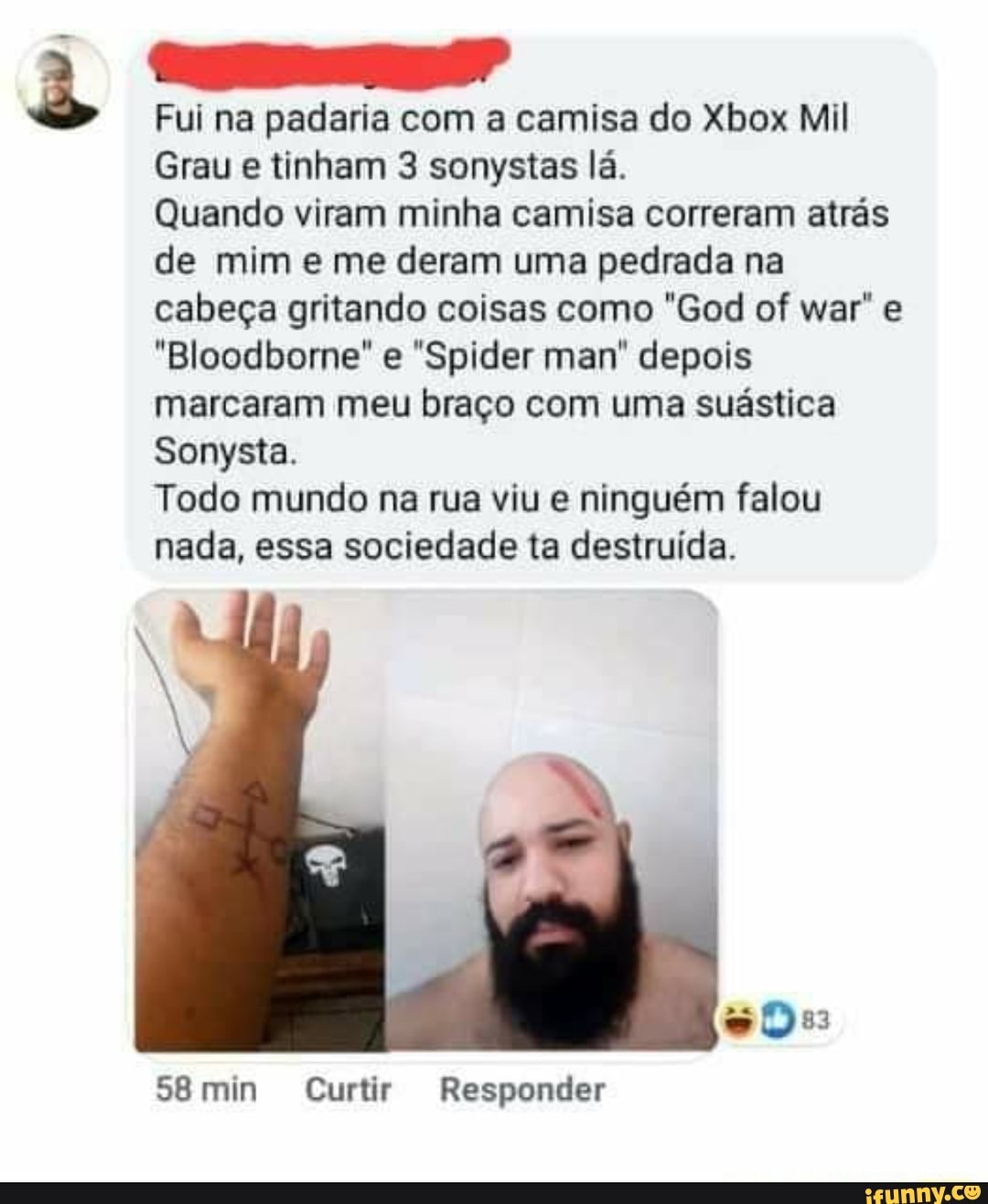 Fui na padaria com a camisa do Xbox Mil
Grau e tinham 3 sonystas lá.
Quando viram minha camisa correram atrás de mim e me deram uma pedrada na cabeça gritando coisas como "God of war' e
"Bloodborne" e "Spider man" depois marcaram meu braço com uma suástica
Todo mundo na rua viu e ninguém falou
Sonysta.
nada, essa sociedade ta destruída.
min Curtir Responder