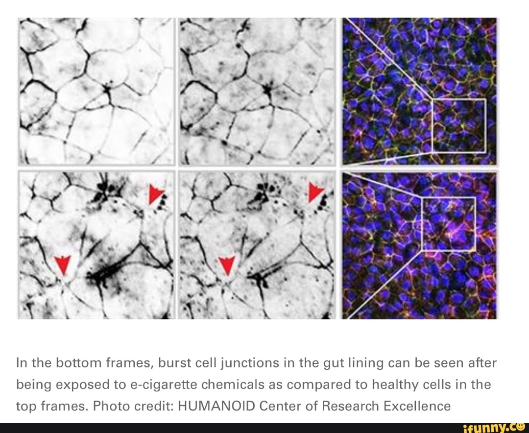 In the bottom frames, burst cell junctions in the gut lining can be ...