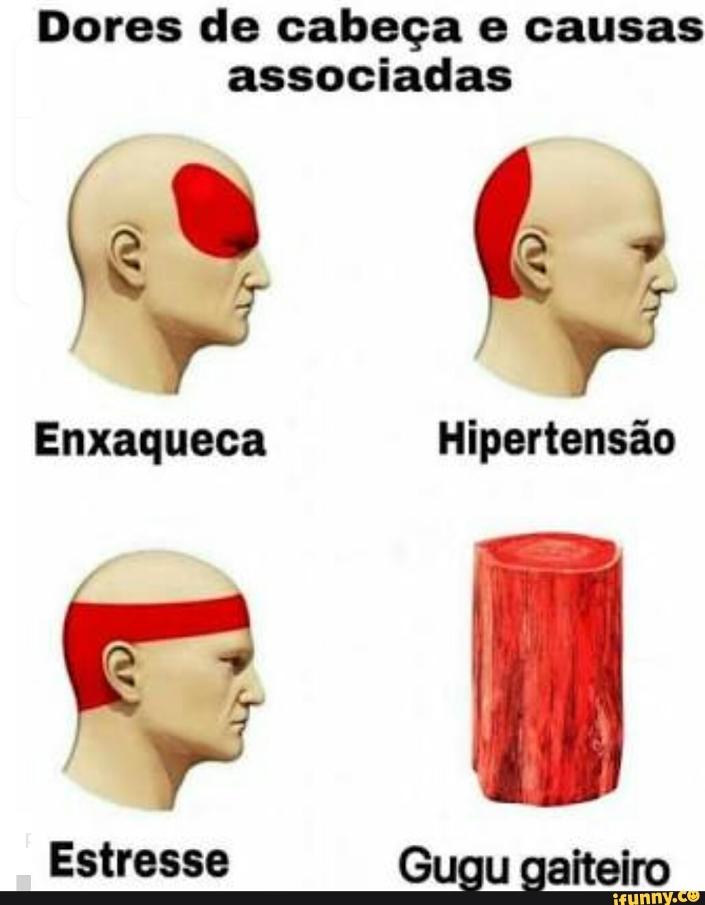 Dores de cabeça e causas
associadas
SUS Gugu gaiteiro