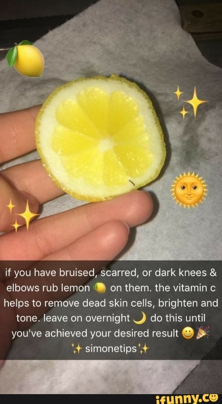 If You Have Bruised Scarred Or Dark Knees Elbows Rub Lemon On Them The Vitamin Helps To Remove Dead Skin Cells Brighten And Tone Leave On Overnight Do Do your elbows and knees look dark and scruffy? dark knees elbows rub lemon