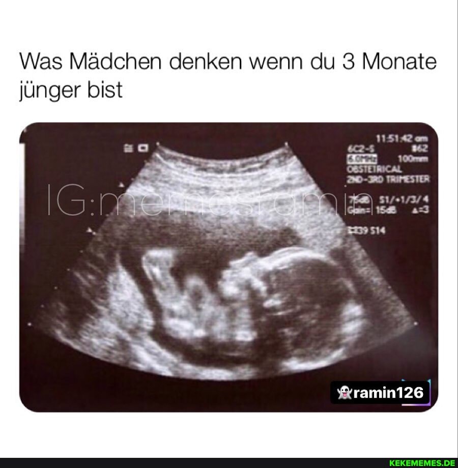 Was Mädchen denken wenn du 3 Monate jünger bist
OBSTEIRICAL
TRIMESTER
514
ramin126