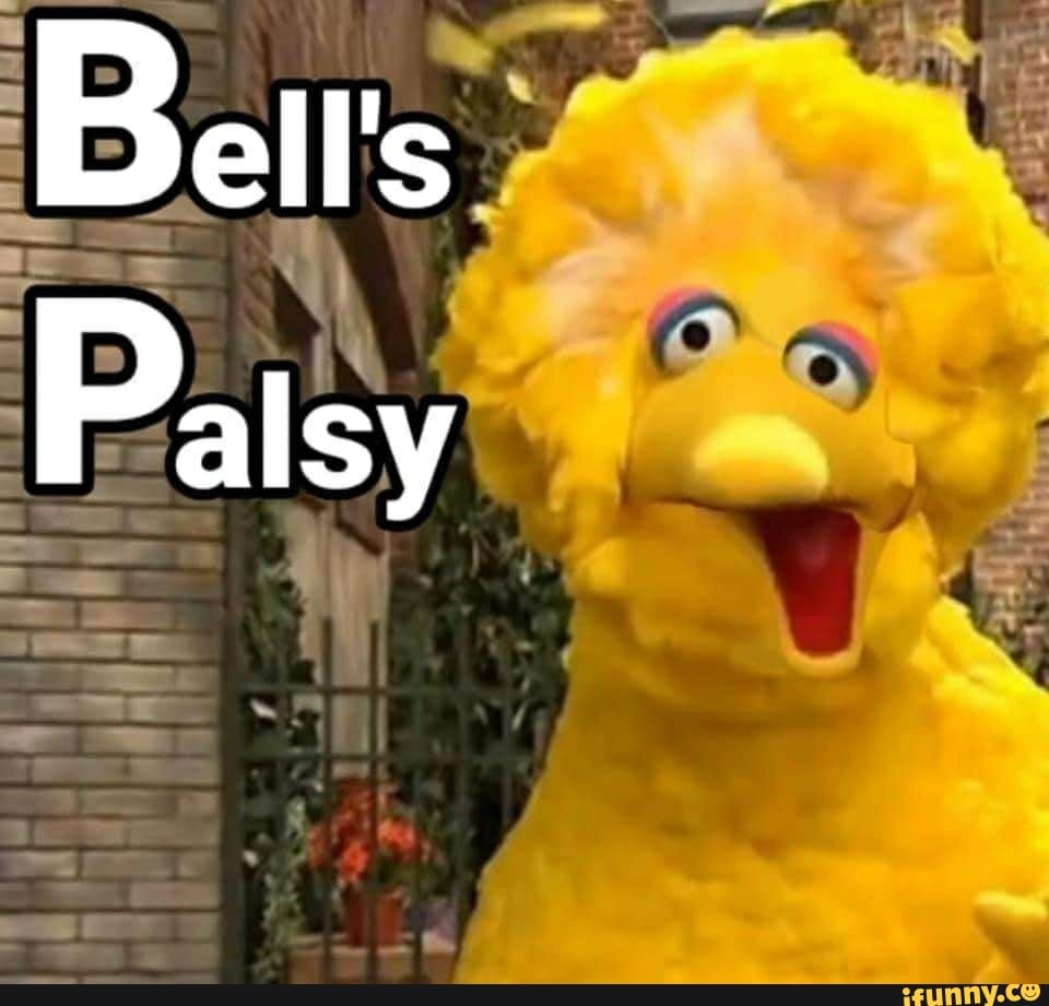 bell-s-palsy-ifunny