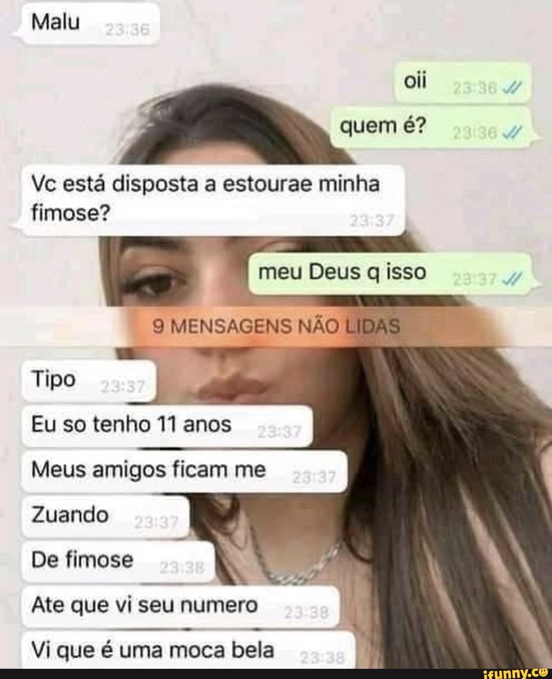 Malu eli quem é? Vc está disposta a estourae minha fimose? meu Deus q isso 9