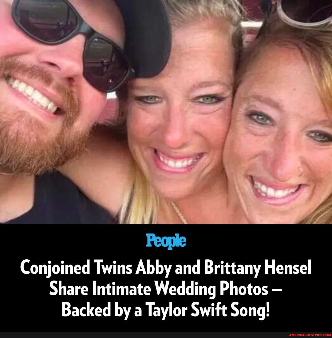 Conjoined twins Abby and Brittany Hensel have offered an inside look at(02)