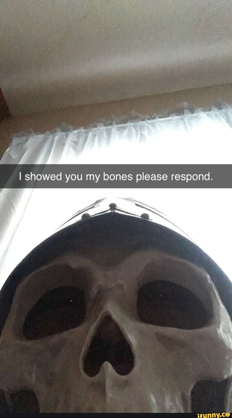 I showed you my bones please respond.