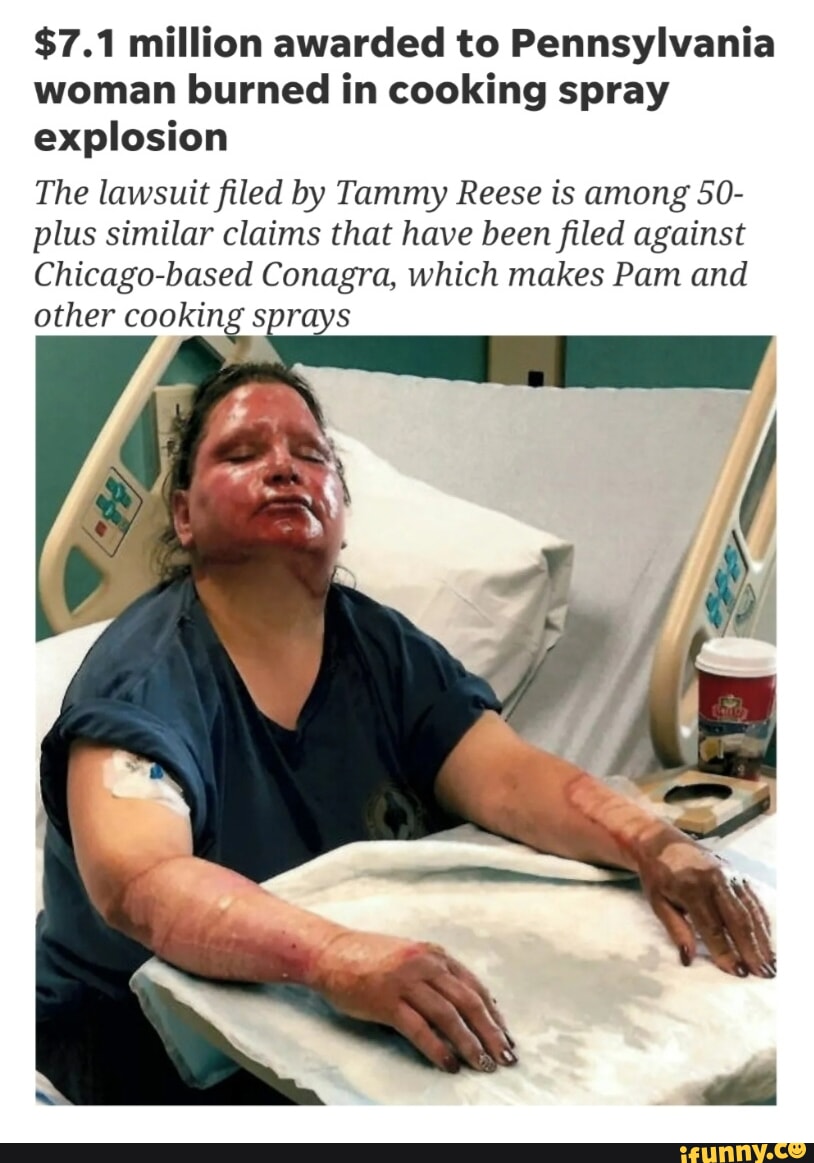 Eight burn victims sue over exploding cans of Pam cooking spray