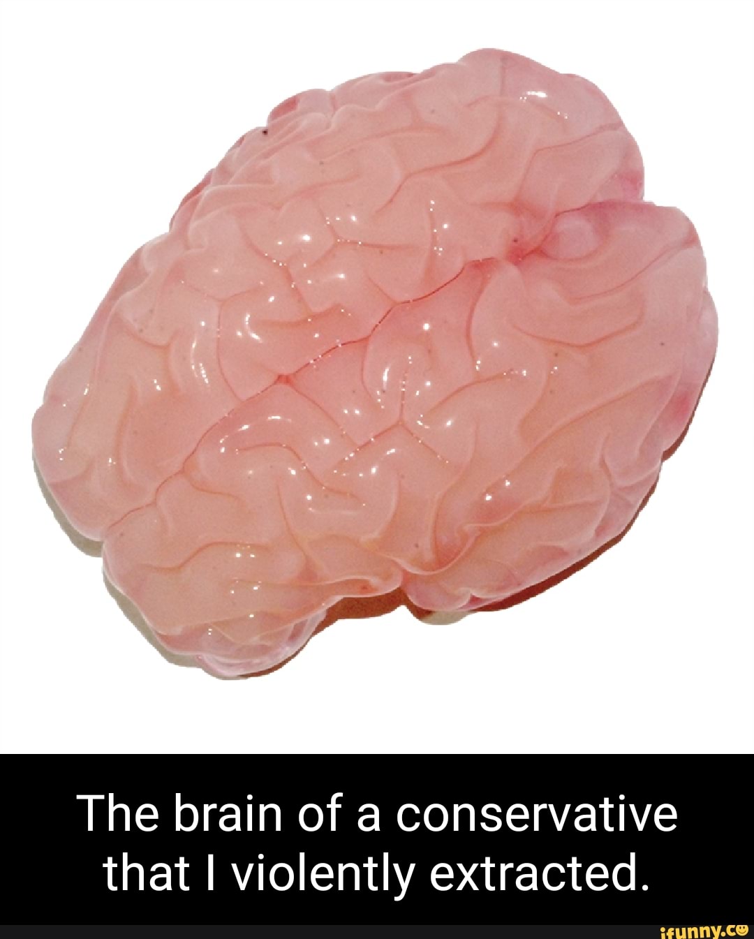 Brain 106
