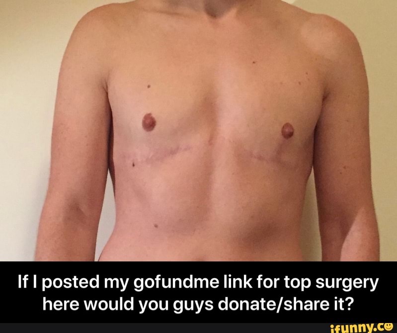If I posted my gofundme link for top surgery
here would you guys donate/share it? - If I posted my gofundme link for top surgery here would you guys donate/share it?