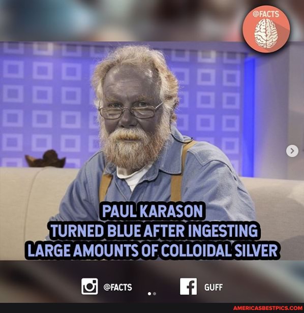PAUL KARASON
_ BLUE AFTER INGESTING
LARGE AMOUNTS OF COLLOIOAL SILVER guer