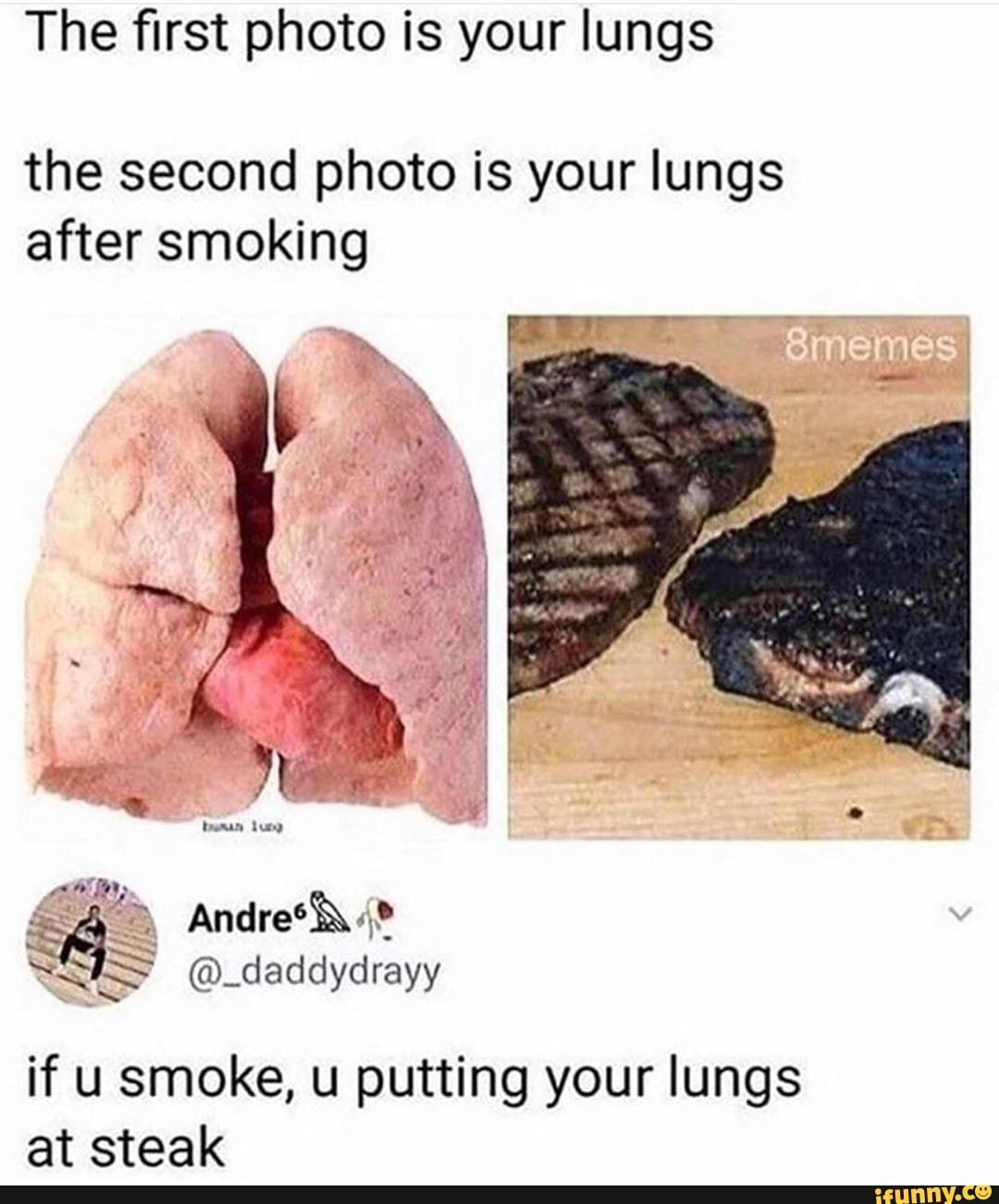 The first photo is your lungs
the second photo is your lungs after smoking
Andres<?
SIS @_daddydrayy
if u smoke, u putting your lungs at steak