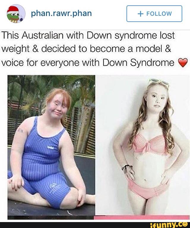 Down Syndrome Slut