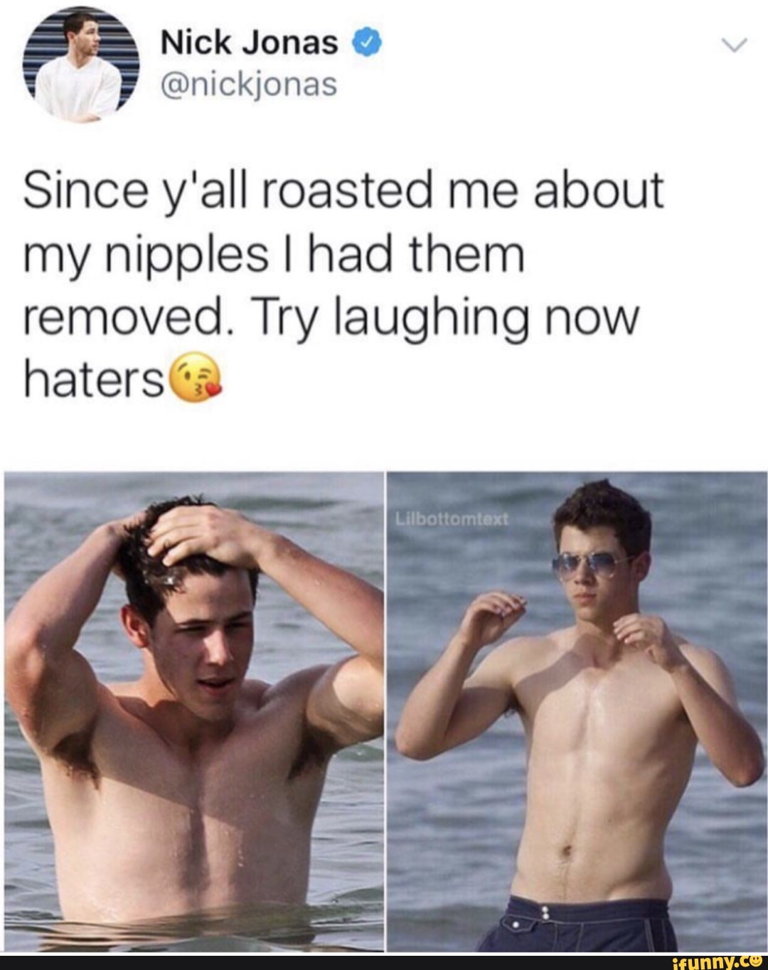 Jonas nipples