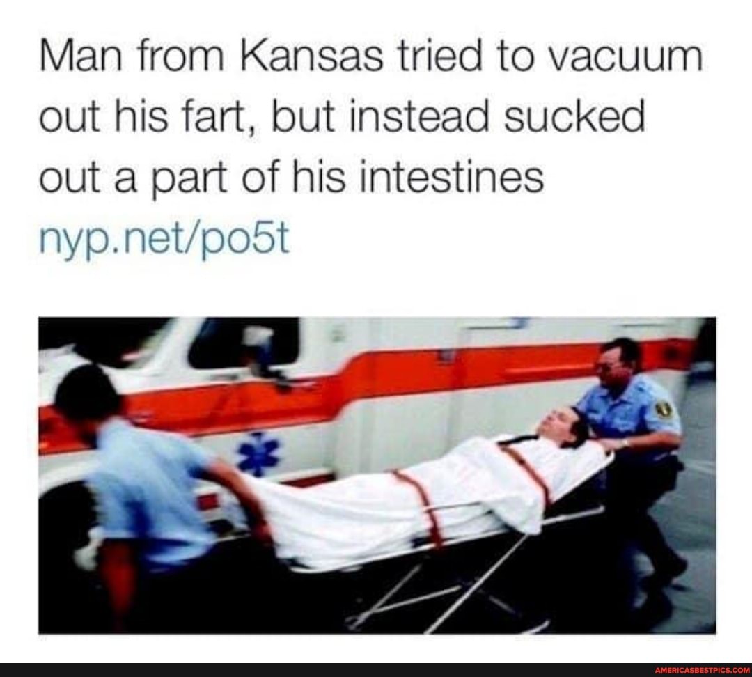 Man from Kansas tried to vacuum out his fart, but instead sucked out a part of his intestines