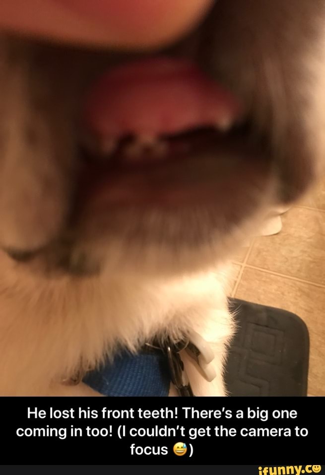 He lost his front teeth! There's a big one
coming in too! (I couldn't get the camera to - He lost his front teeth! There’s a big one coming in too! (I couldn’t get the camera to focus 😅)