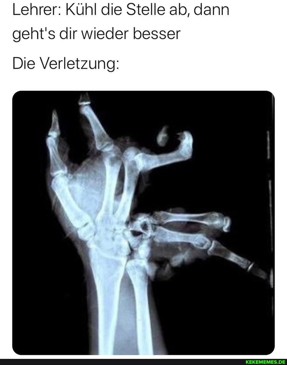 Lehrer: Kühl die Stelle ab, dann geht's dir wieder besser
Die Verletzung: