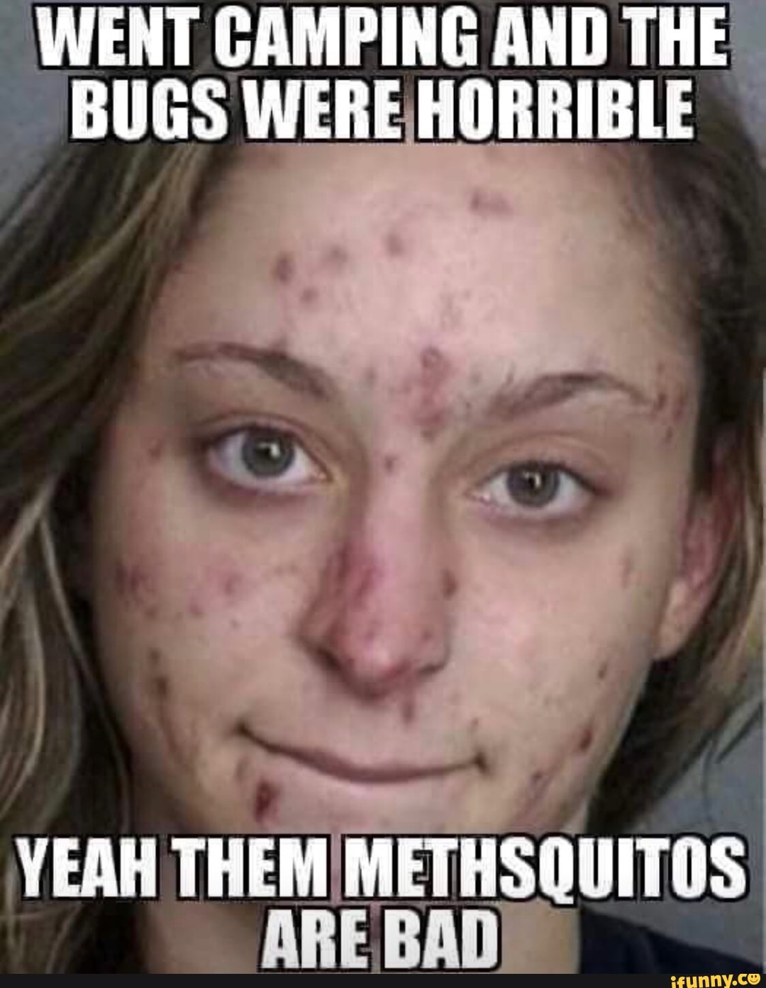 WENT CAMPING AND THE BUGS WERE HORRIBLE
YEAR THEM MENRSOUTTES