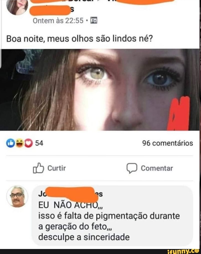 Ontem ás [E
Boa noite, meus olhos são lindos né?
54 96 comentários
Curtir Comentar se Jo as
EU NÃO isso é falta de pigmentação durante a geração do feto,, desculpe a sinceridade