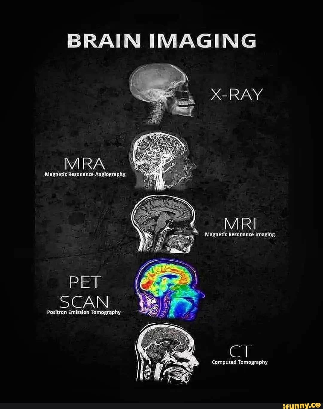 BRAIN IMAGING