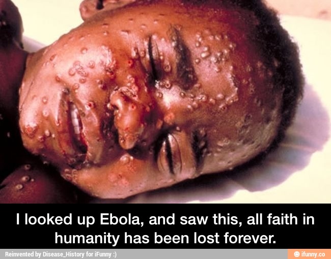 I looked up Ebola, and saw this, all faith in
humanity has been lost forever. - I looked up Ebola, and saw this, all faith in humanity has been lost forever.