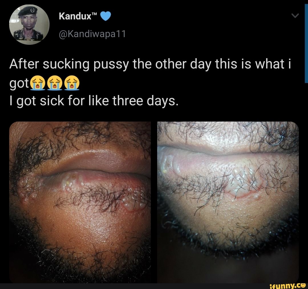 sucking pussy the this
goth SS
I got sick for like three days.