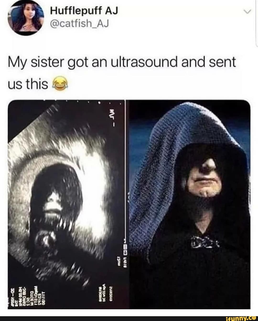My sister got an ultrasound and sent