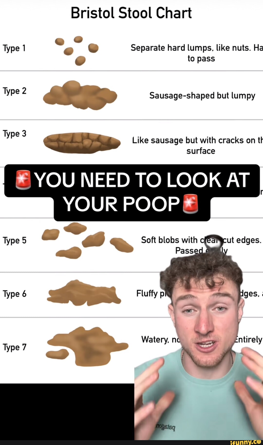 Bristol Stool Chart Type 1 @ Separate hard lumps. like nuts. Ha to pass ...