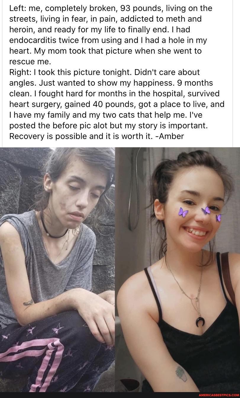 Left: me, completely broken, 93 pounds, living on the streets, living in fear, in pain, addicted to meth and heroin, and ready for my life to finally end. I had endocarditis twice from using and I had a hole in my heart. My mom took that picture when she went to rescue me.
Right: I took this picture tonight. Didn't care about angles. Just wanted to show my happiness. 9 months clean. I fought hard for months in the hospital, survived heart surgery, gained 40 pounds, got a place to live, and have my family and my two cats that help me. I've posted the before pic alot but my story is important.
Recovery is possible and it is worth it. -Amber