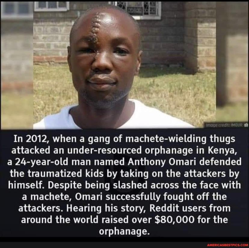 In 2012, when a gang of machete welding thugs attacked an under-resourced orphanage in Kenya, a 24-year-old man named Anthony Omari defended the traumatized kids by taking on the attackers by himself. Despite being slashed across the face with a machete, Oman successfully fought off the attackers. Hearing his story, Reddit users from around the world raised over $80,000 for the orphanaae.