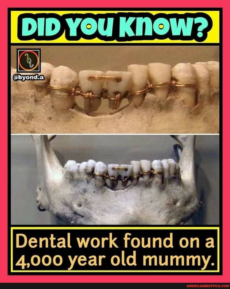 DID You KNOW?)
ell
Dental work found on aI I4,000 year old mummy.