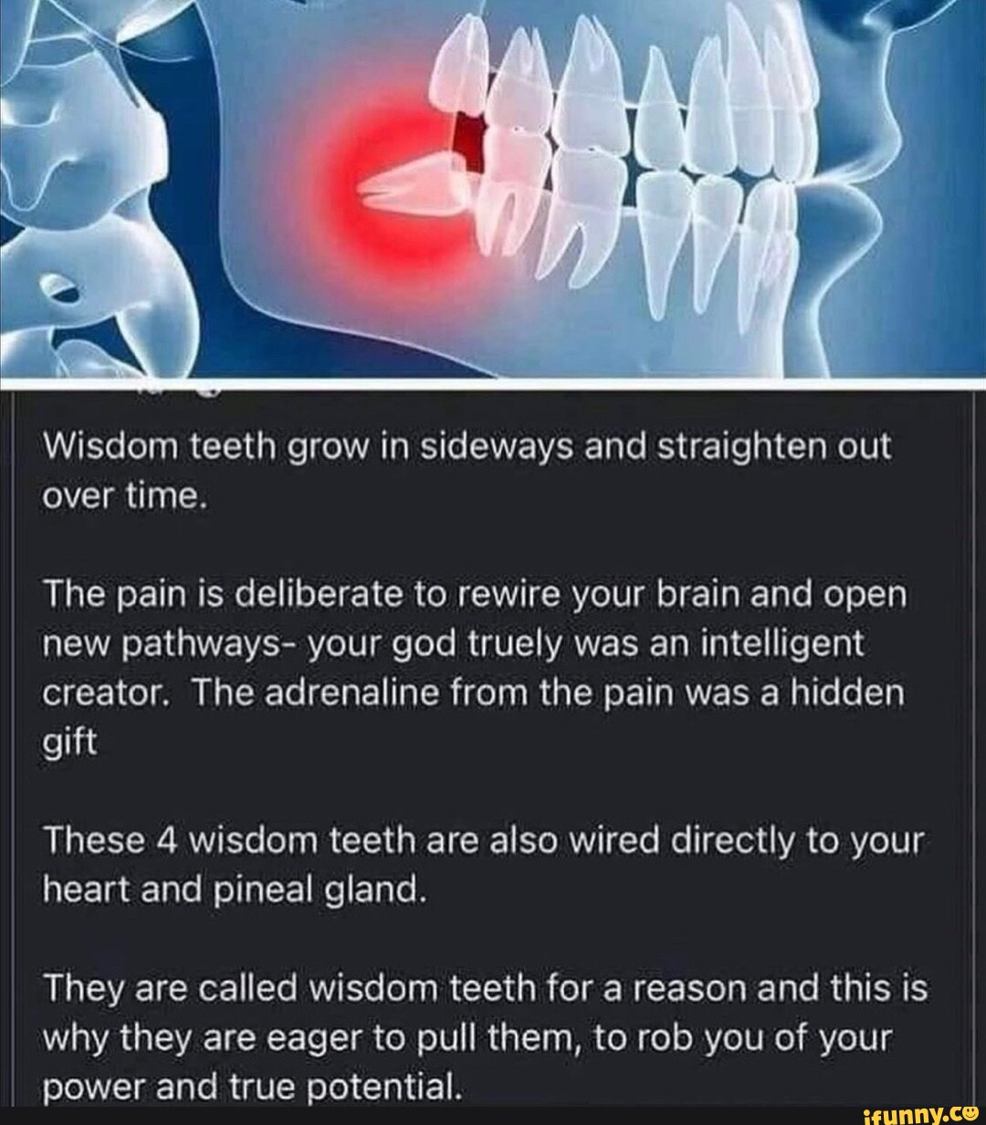 Wisdom teeth grow in sideways and straighten out over time. The pain is deliberate to rewire