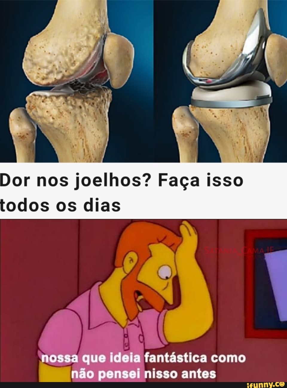 Dor nos joelhos? Faça isso
odos os dias
nossa que ceia fantástica como
non pensei nisso antes