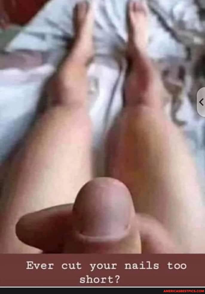 Ever cut your nails too
ehort?