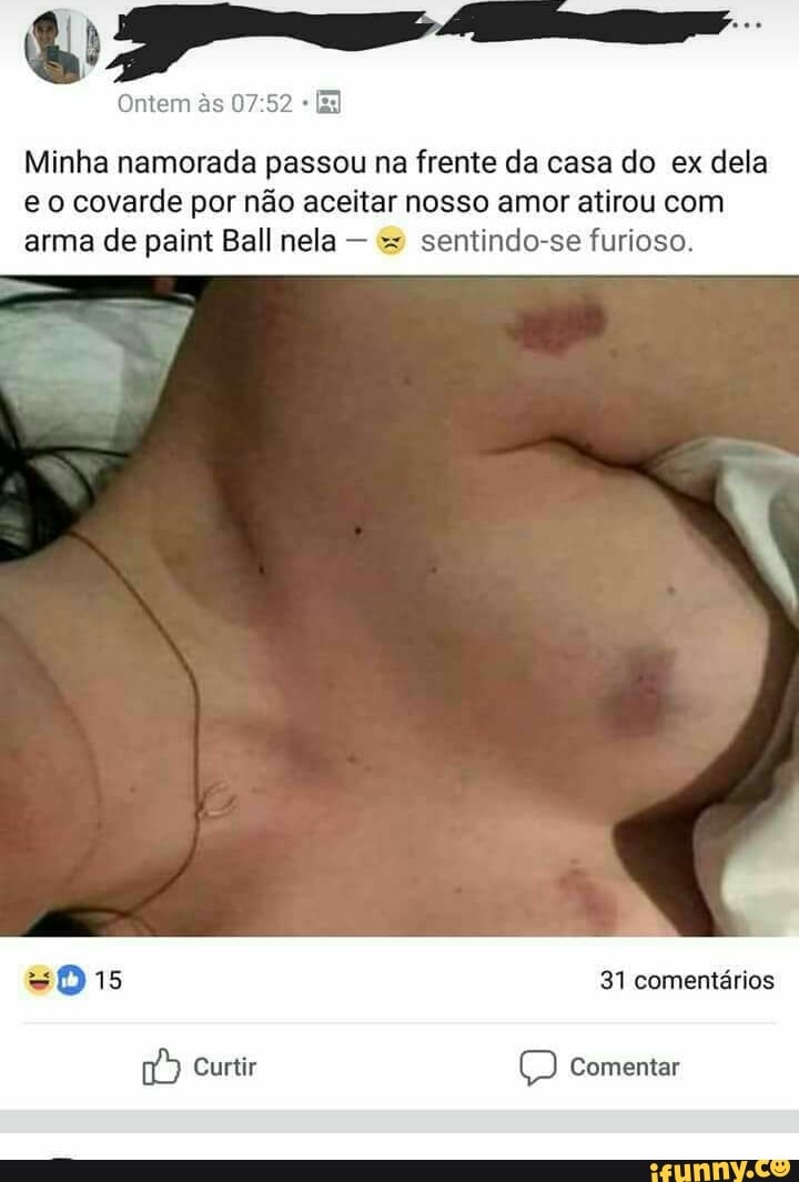 Ontem às 07:52 Minha namorada passou na frente da casa do ex dela
eo covarde por não aceitar nosso amor atirou com
arma de paint Ball nela sentindo-se furioso.