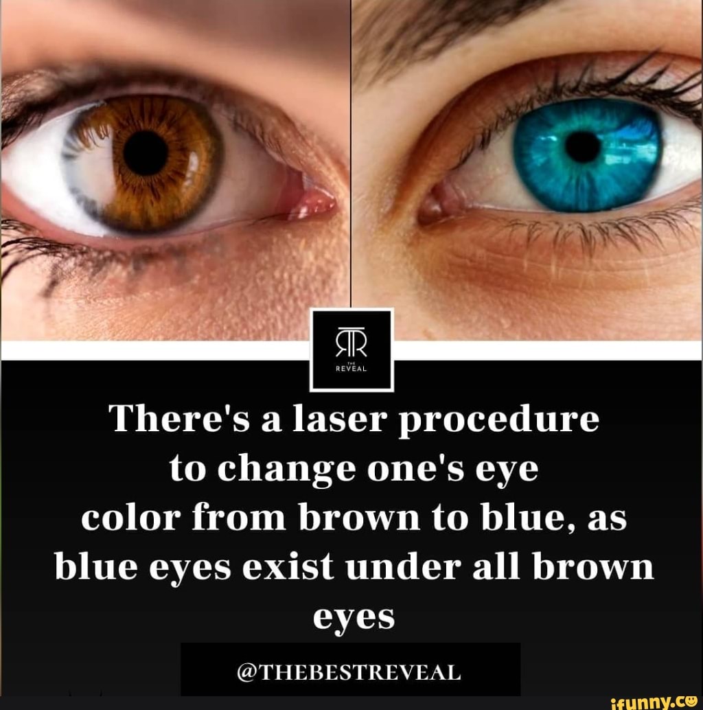 There's a laser procedure to change one's eye color from