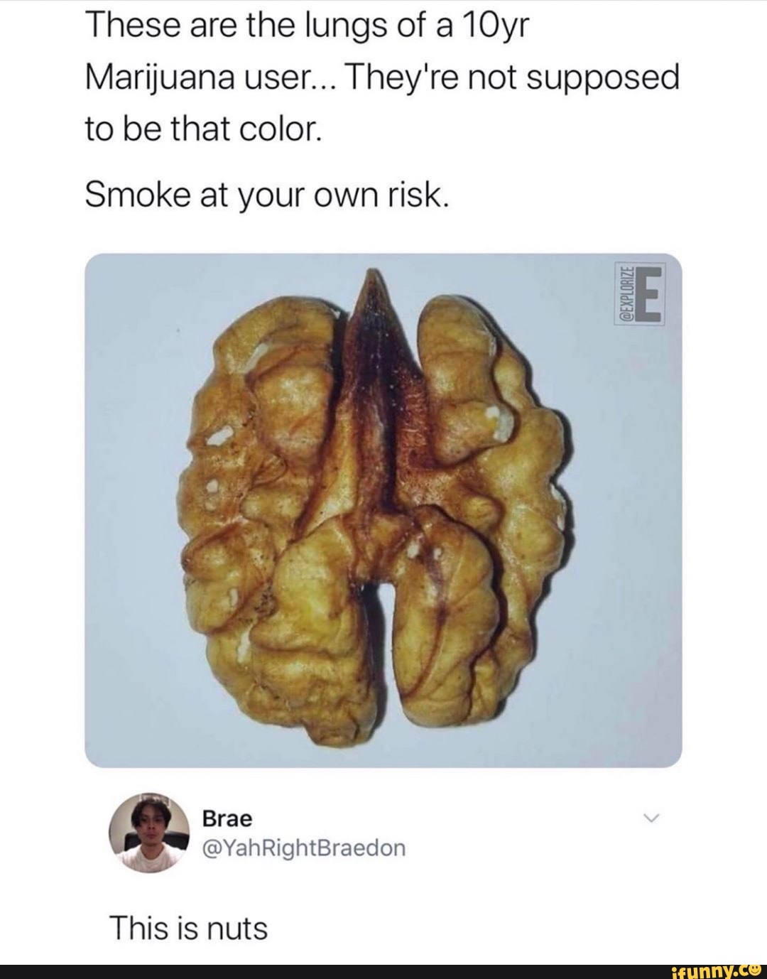 These are the lungs of a 10yr
Marijuana user... They're not supposed to be that color.
Smoke at your own risk.
This is nuts