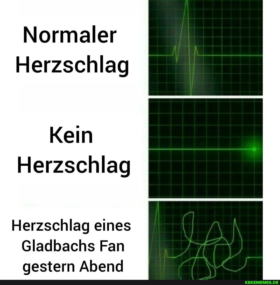Normaler
Herzschlag
Kein
Herzschlag
Herzschlag eines
Gladbachs Fan gestern Abend
