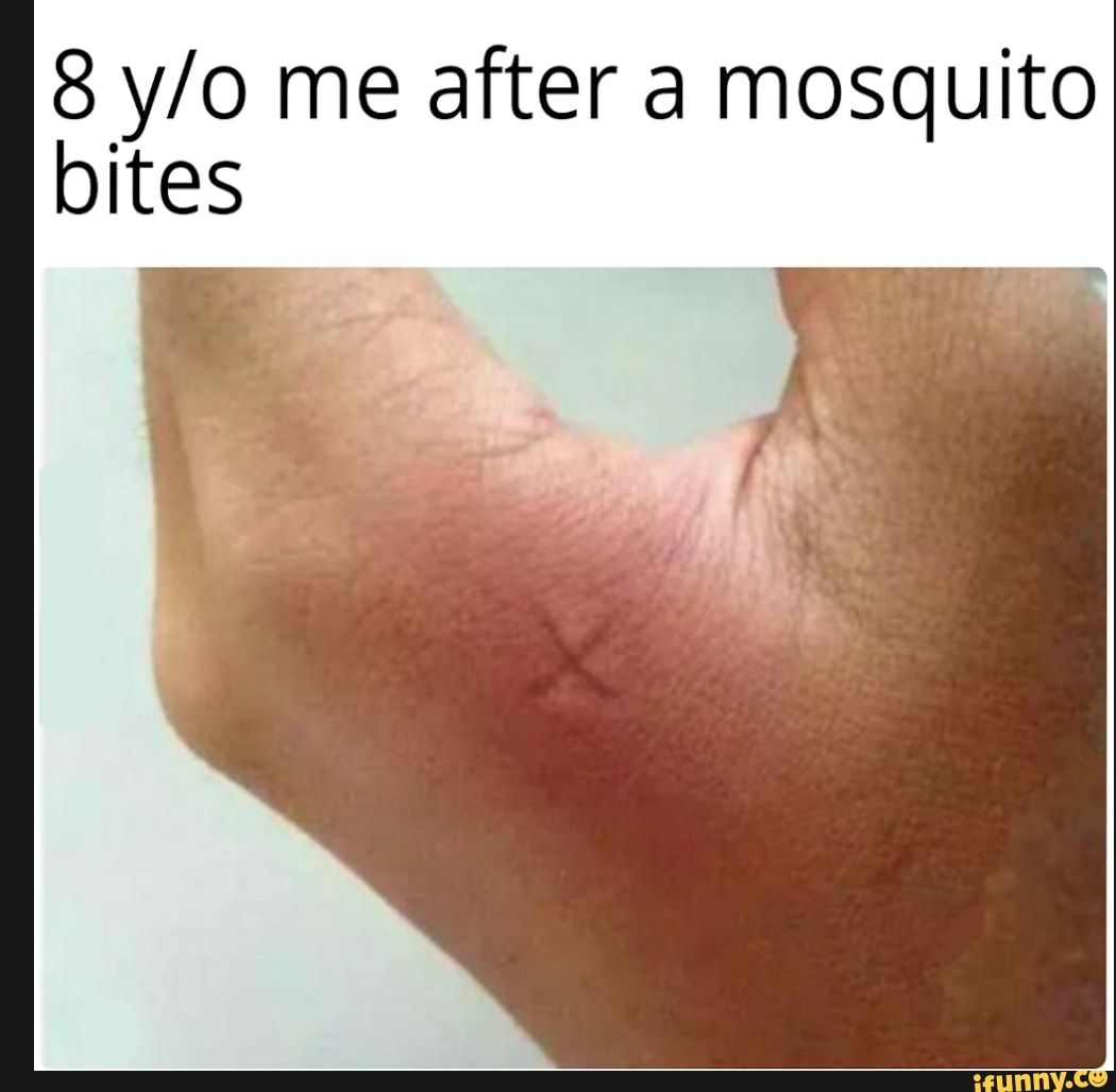 8 me after a mosquito bites