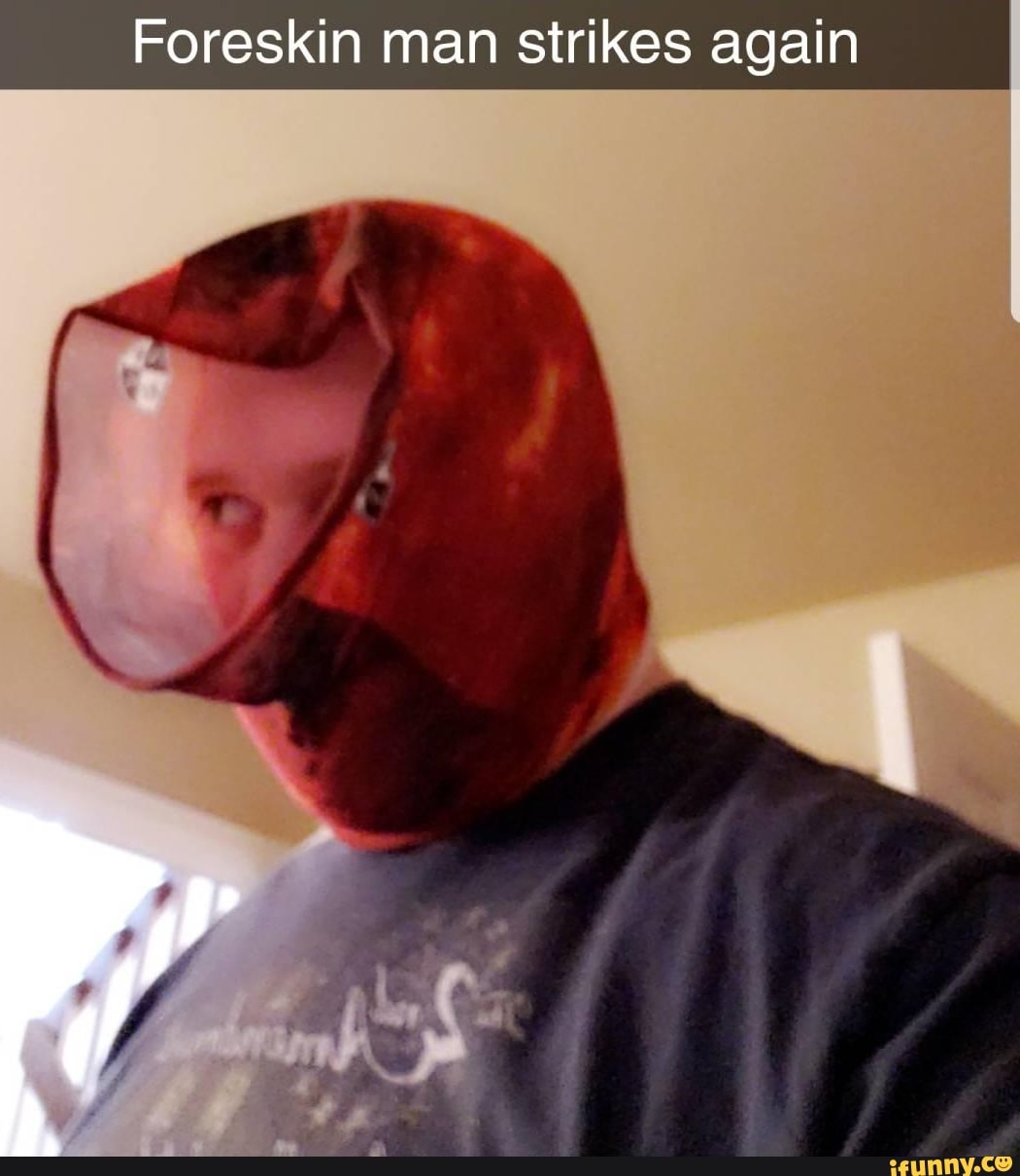 Foreskin man strikes again