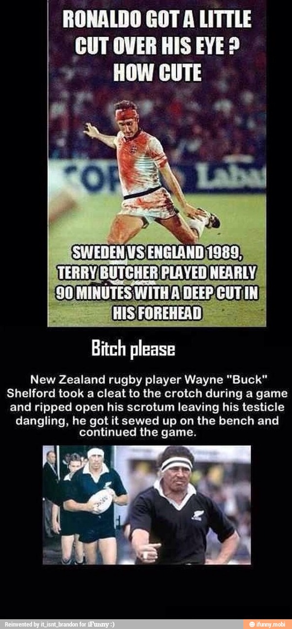 RONALDO GOT A LITTLE CUT OVER HIS EYE? TERRY BUTCHER PLAYED NEARLY, (90