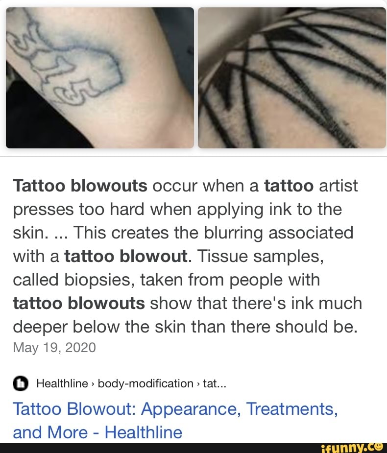 What Is Tattoo Blowout  Can You Fix It  AuthorityTattoo