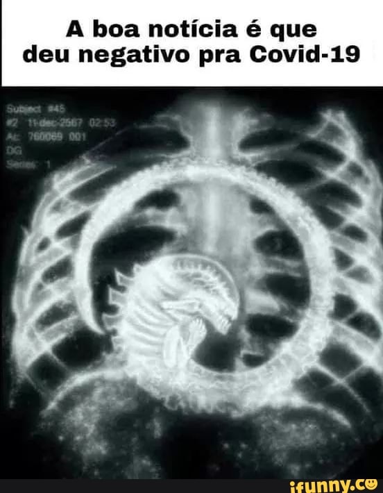 A boa notícia é que
deu negativo pra Covid-19
