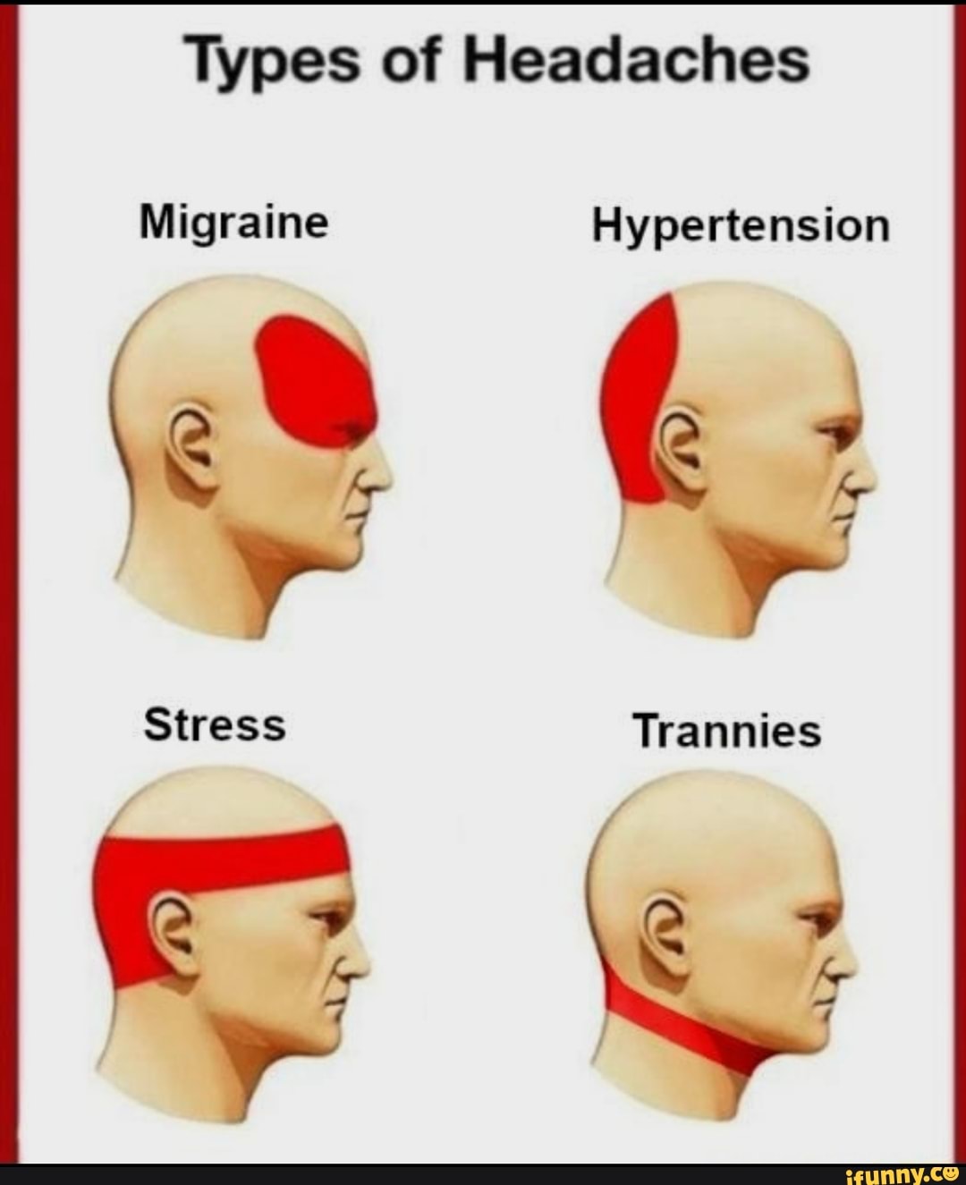 Types of Headaches Migraine Hypertension om~ Stress - iFunny