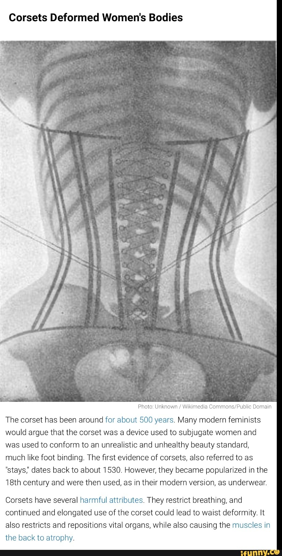 Corsets Deformed Women's Bodies Photo Unkno\ Nikimedia Domain The