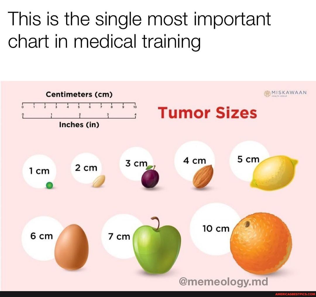 Second opinion said it was actually a strawberry sized tumor - This is ...